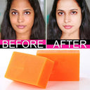 GuanJing Beauty Kojic Acid Whitening Soap For Face And Body